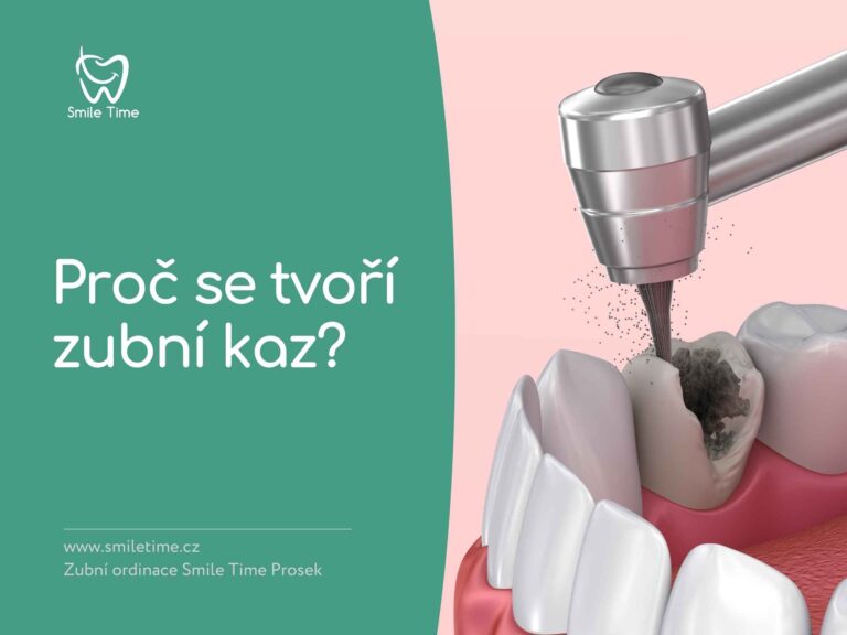 Why Do Cavities Form?