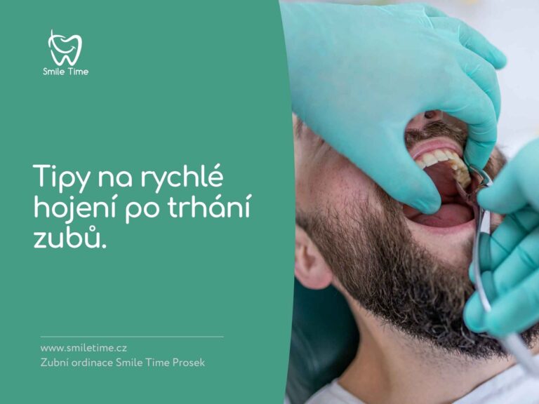 Tips for Fast and Smooth Healing After Tooth Extraction